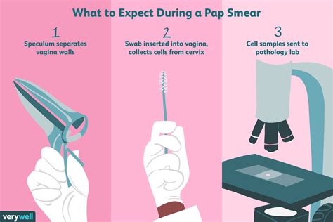 paper smear test for white discharge|The Pap (Papanicolaou) Test .